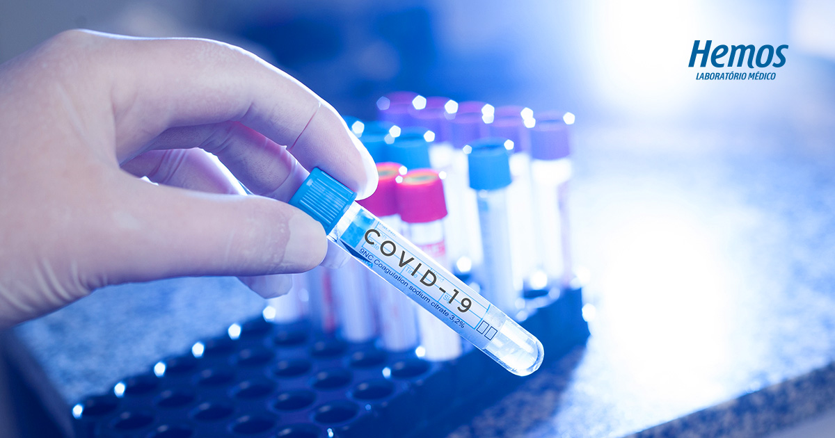 O que é Dímero D e sua importância no diagnóstico de Covid19 Hemos